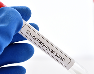 Nasopharyngeal Swab Collection